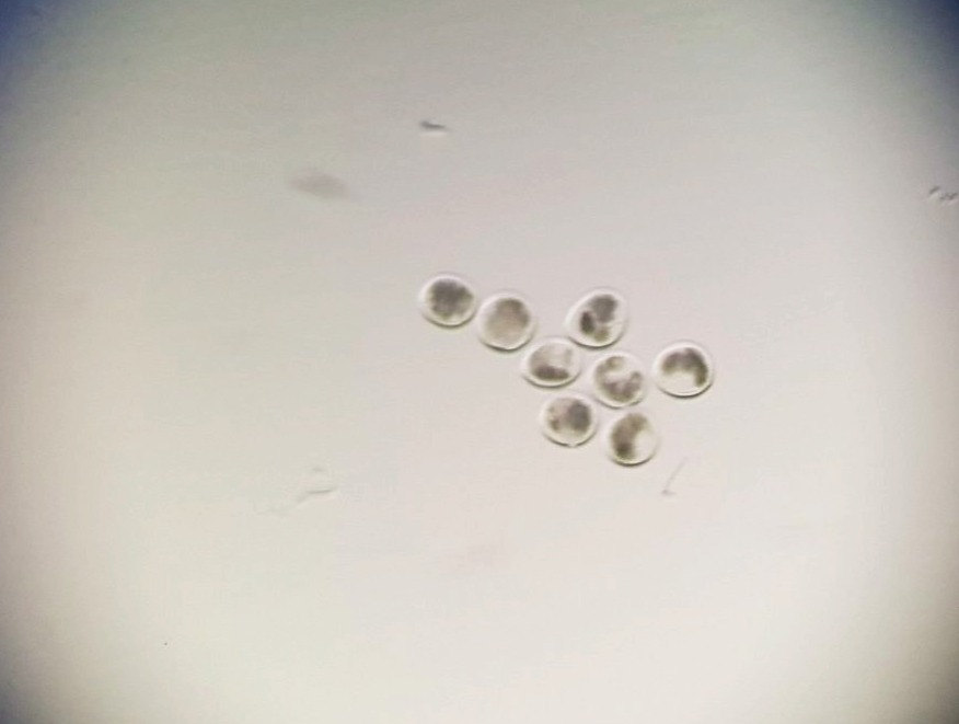 Embryos in a culture dish
